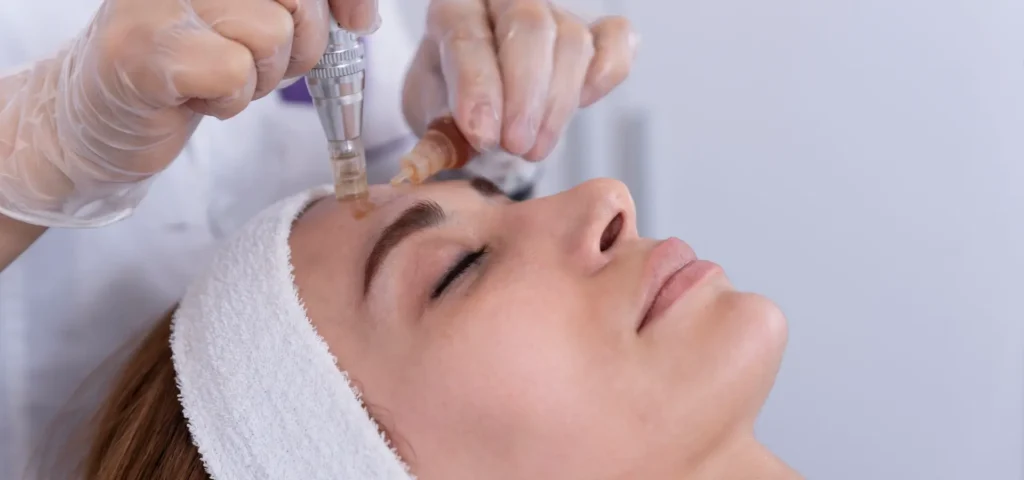cuidados después del dermapen