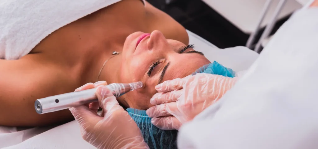 dermapen vs dermaroller