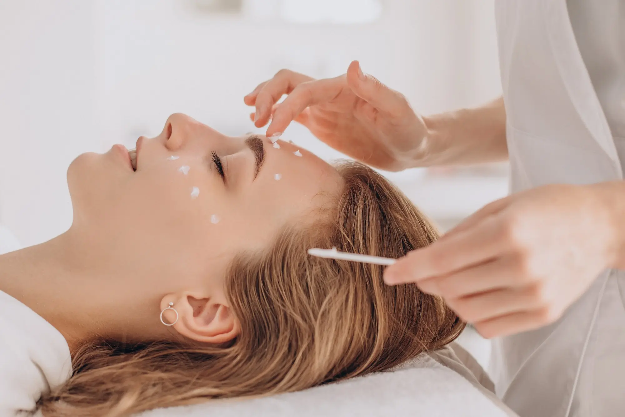 Especialistas en tratamientos de Dermapen en Málaga con resultados visibles